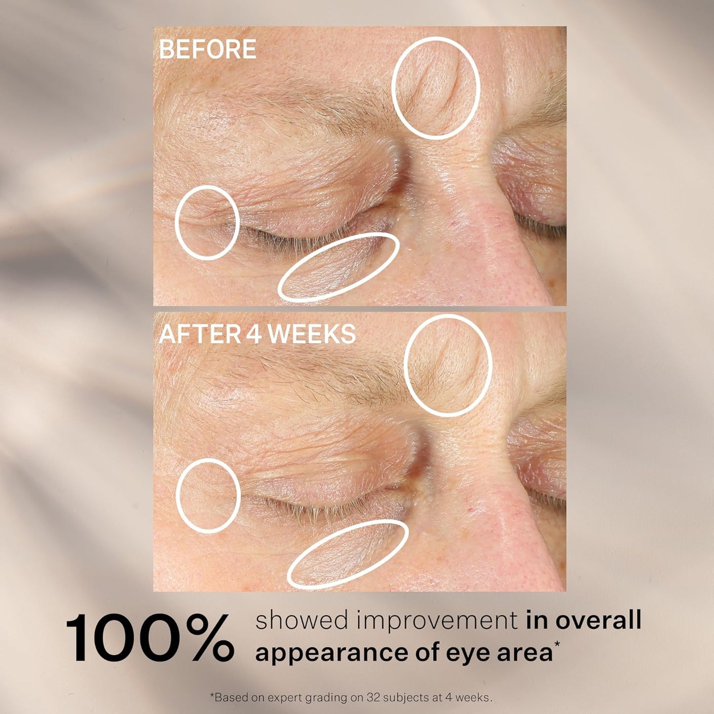 StriVectin Anti-Wrinkle Intensive Eye Cream Concentrate for Wrinkles PLUS, Targets Crow's Feet, Firmness, Puffiness and Dark Circles