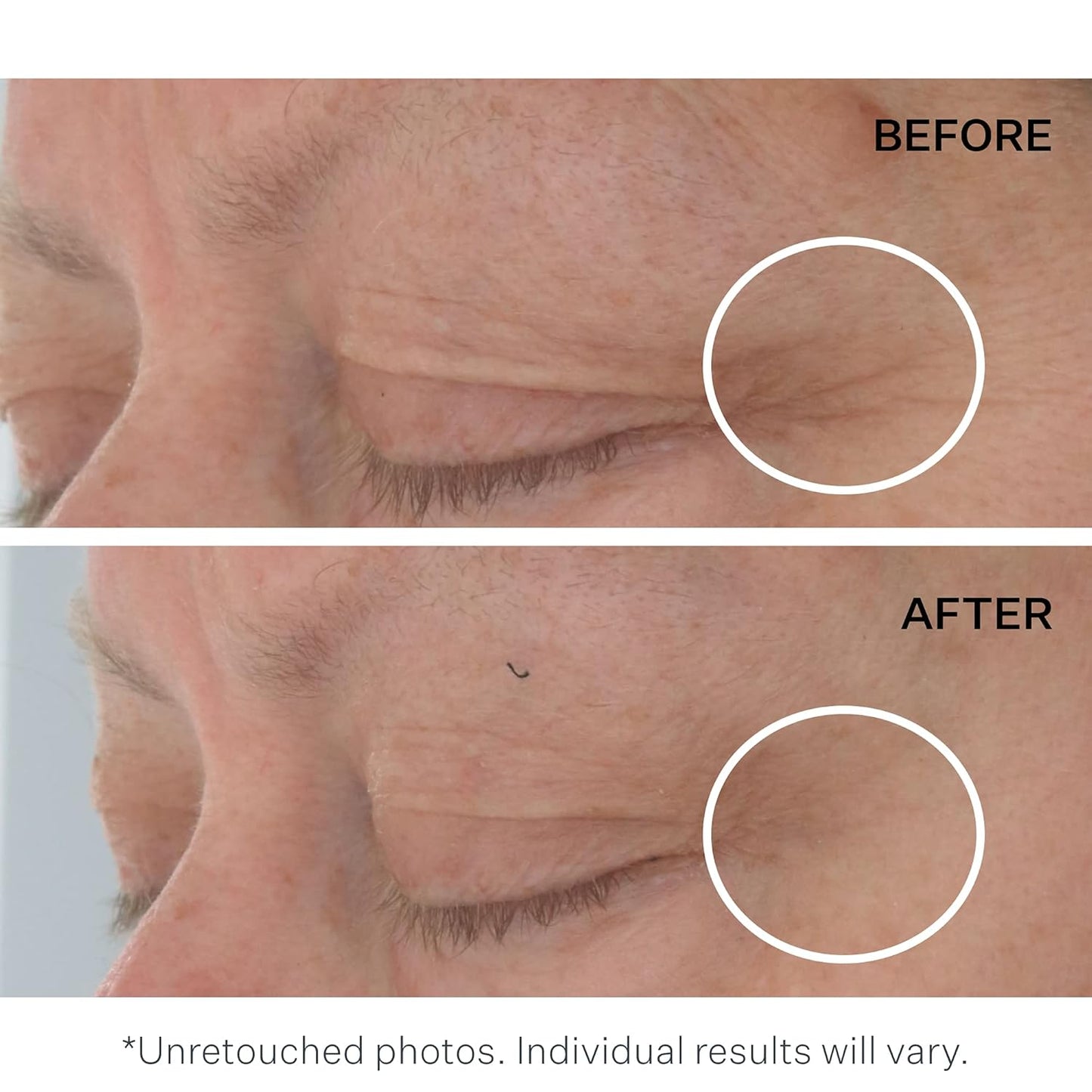 StriVectin Multi Action Hydration Multiplier Serum with Hyaluronic Acid, Ceramides and Peptides for Dehydrated, Dry Skin