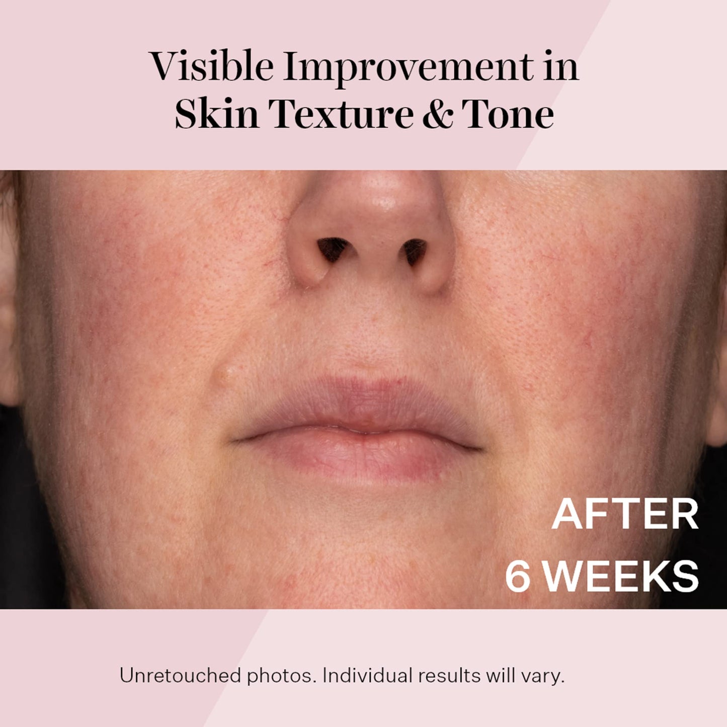 StriVectin Advanced Retinol, Targets Visible Signs of Aging for Healthier Skin