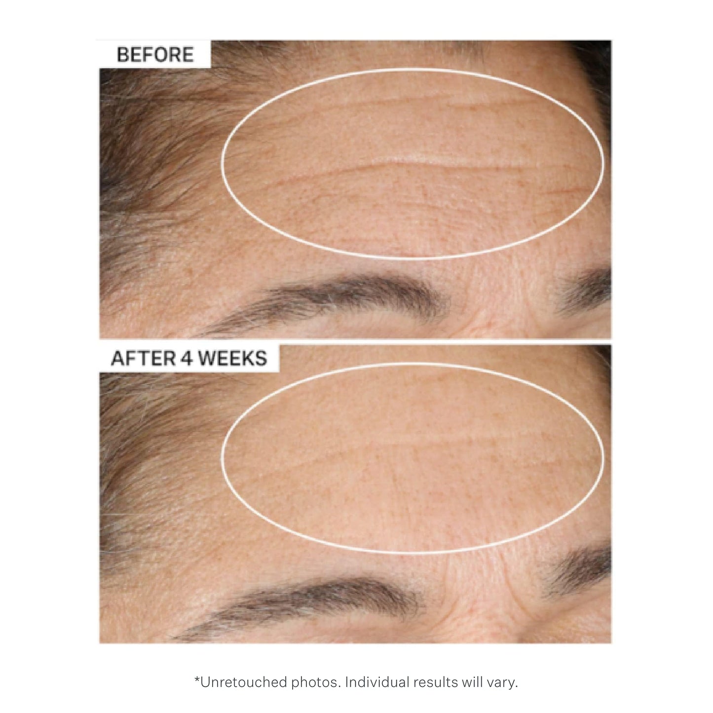 StriVectin Advanced Retinol, Targets Visible Signs of Aging for Healthier Skin
