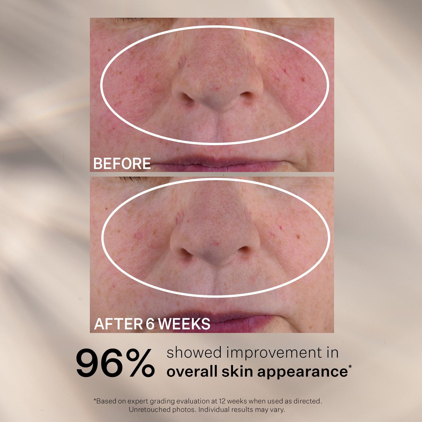 StriVectin Advanced Retinol, Targets Visible Signs of Aging for Healthier Skin
