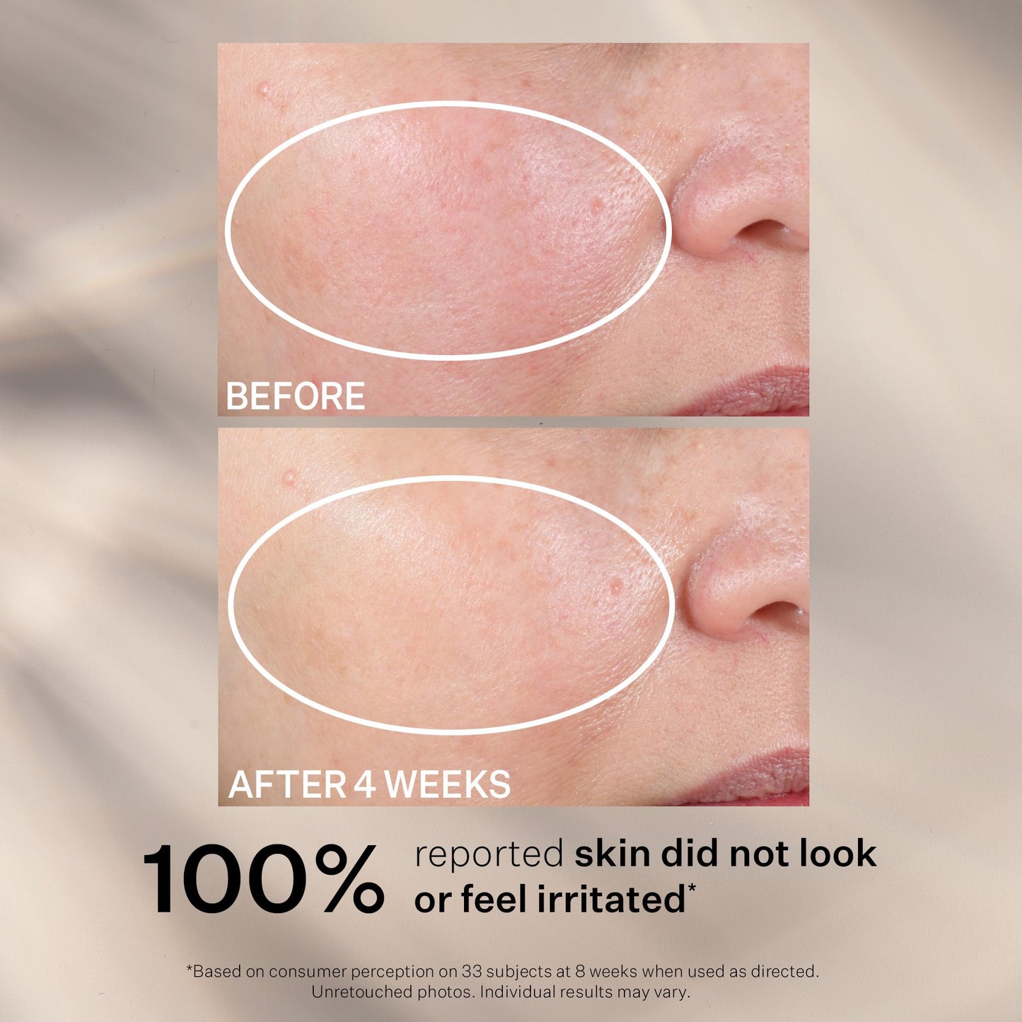 StriVectin Advanced Retinol, Targets Visible Signs of Aging for Healthier Skin