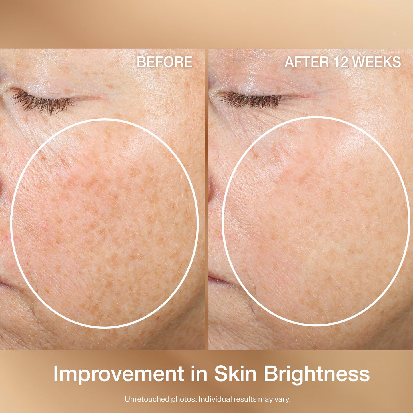 StriVectin Multi Action Super C Retinol Brightening & Correcting Serum