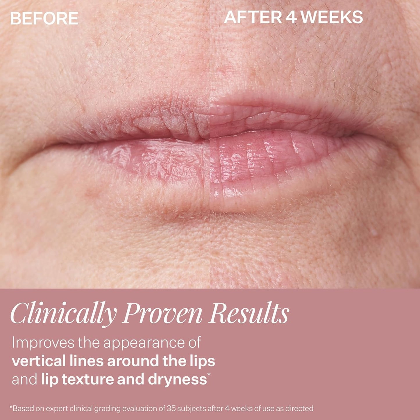 StriVectin Anti-Wrinkle Intensive Eye Cream Concentrate for Wrinkles PLUS, Targets Crow's Feet, Firmness, Puffiness and Dark Circles