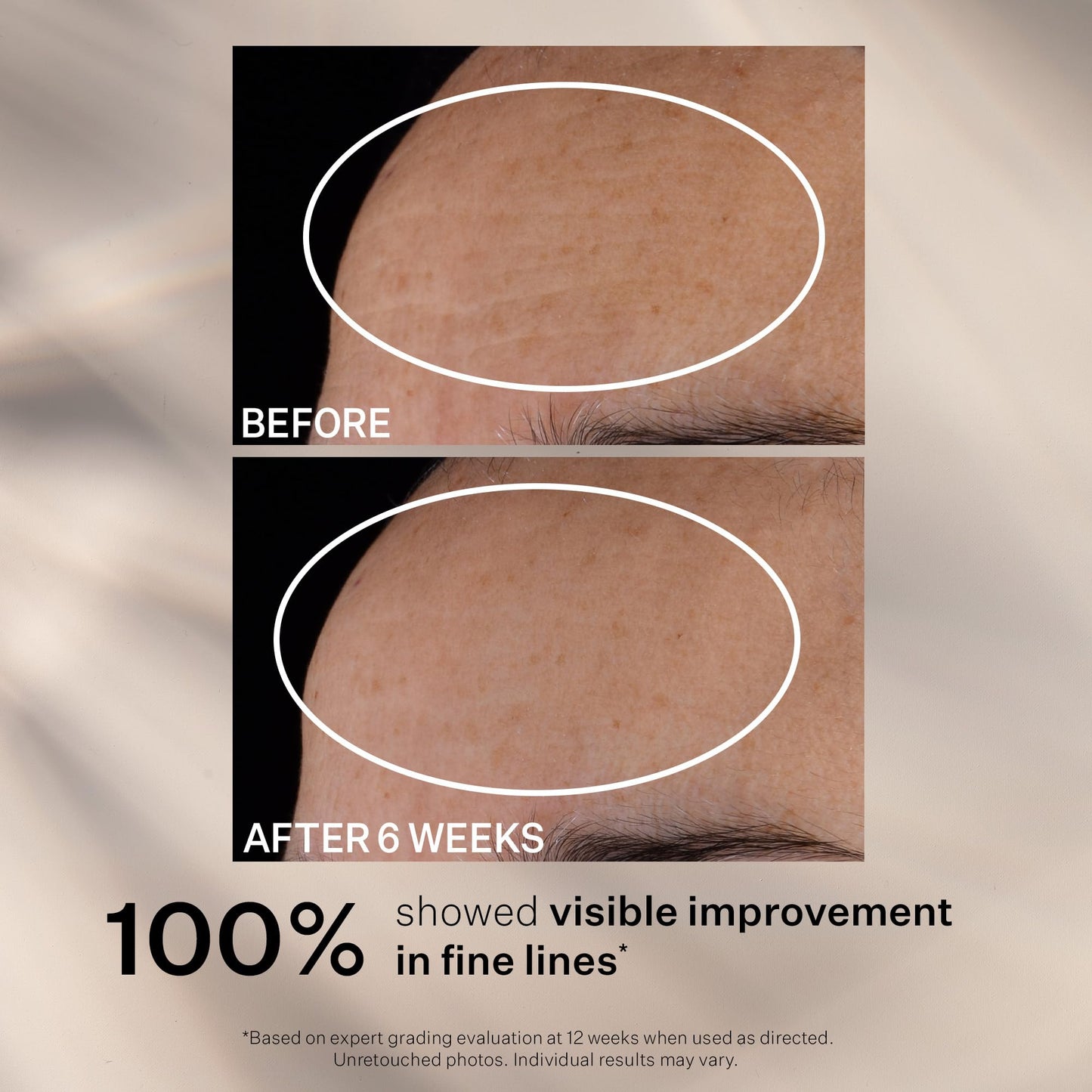 StriVectin Advanced Retinol, Targets Visible Signs of Aging for Healthier Skin